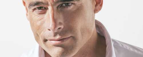 Facial rejuvenation in men