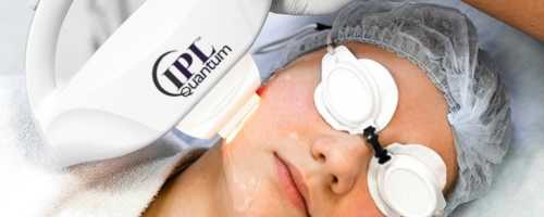 El tratamiento de luz pulsada intensa que mejora la calidad de tu piel, elimina manchas y rejuvenece tu rostro