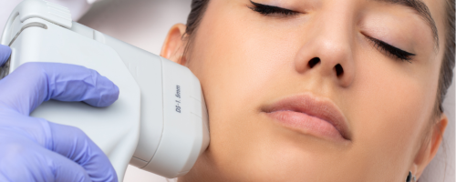 Descubre cómo el tratamiento HIFU mejora la firmeza, elasticidad y luminosidad de tu rostro de forma segura y efectiva