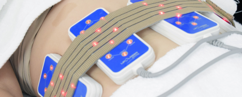 The revolutionary treatment to eliminate localized fat without scalpel or recovery time.